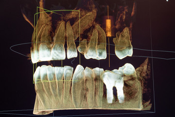dental radiography 2