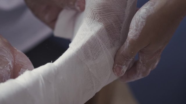 Doctors impose plaster on the leg of the patient