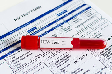 Red blood vial with blood sample over HIV test form background.