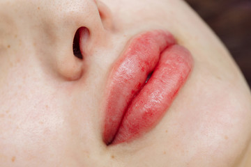 Lips after permanent makeup in beauty salon