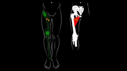 Adductor longus muscle. Adductor brevis muscle. Trigger points and reflected pain on the inner thigh.