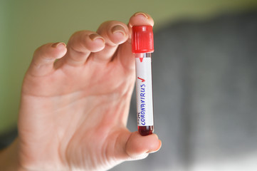 Researcher holds test tube with coronavirus virus, analysis and medicine to fight the epidemic. B