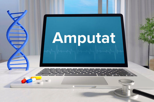 Amputat &ndash; Medizin/Gesundheit. Computer im B&uuml;ro mit Begriff auf dem Bildschirm. Arzt/Gesundheitswesen