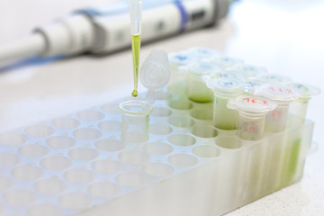 Clinical laboratory in process of chemical analysis. Collection of probe using automatic pipette.