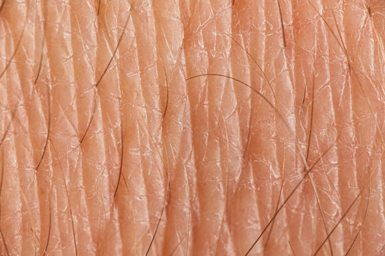 European human skin with hairs, closeup. Care and health.
