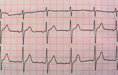 Naklejka premium cardiogram EKG with the heartbeat