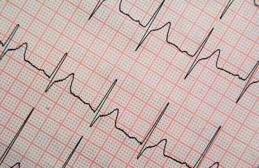 graphic line with the heartbeat EKG