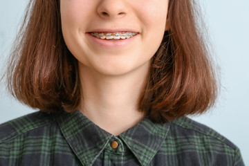 Teenage girl with dental braces on light background, closeup