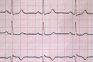 cardiogram, background image, selective focus