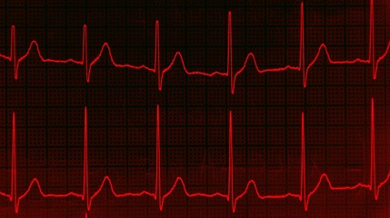 an EKG electrocardiogram with heart pulse