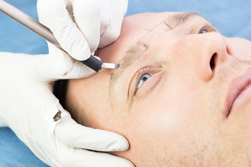 Male microblading procedure to improve the condition of a man’s eyebrows in a beauty salon.