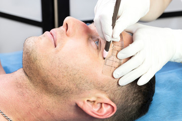 Fototapeta premium Male microblading procedure to improve the condition of a man’s eyebrows in a beauty salon.