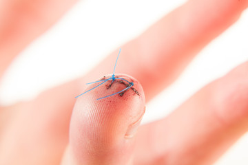 A deep wound is sewn on the middle finger of the hand