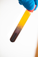 Platelet Rich Plasma PRP R&ouml;hrchen