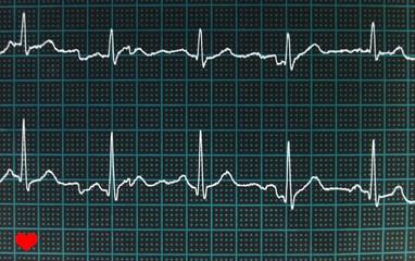 cardiogram EKG with the heartbeat