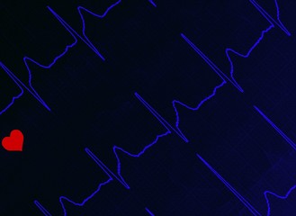 Fototapeta na wymiar an EKG electrocardiogram with heart pulse