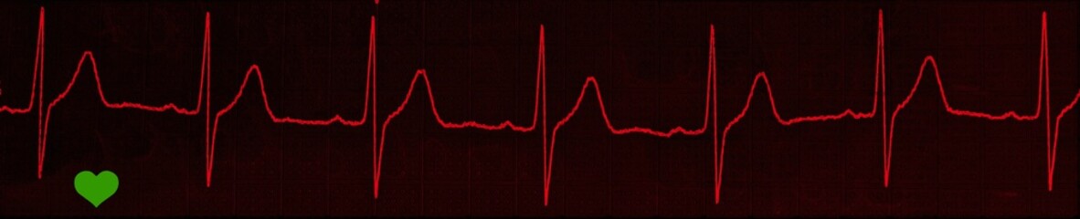 an EKG electrocardiogram with heart pulse