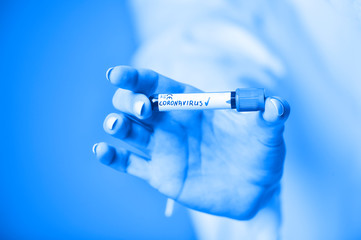 Nurse holding a positive blood test result for the new rapidly spreading Coronavirus. Blue filter.