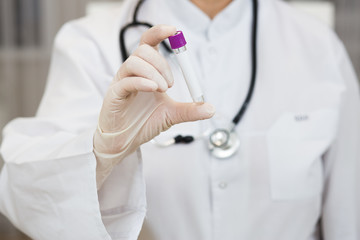 a doctor, with a phonendoscope around her neck and gloves, holds a positive blood test forvirus....