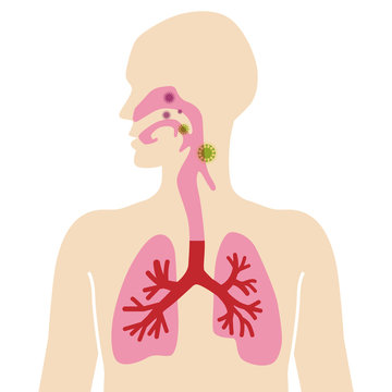 Anatomical human body diagram for Respiratory system -infected with virus