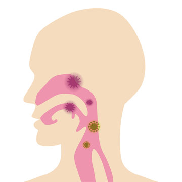 human head profile with virus infection clip art preview