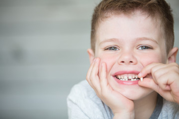 Teenager child with a tooth dropped out