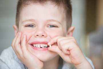 Teenager child with a tooth dropped out