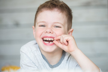 Teenager child with a tooth dropped out