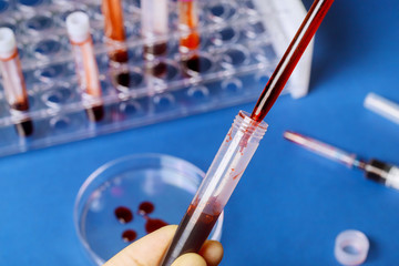 Pipette adding fluid of biochemistry blood medical testing on microbiology lab