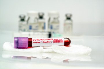 Coronavirus blood test .  Coronavirus negative blood in laboratory.