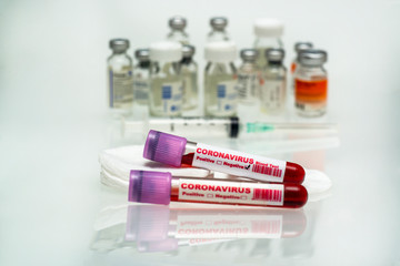 Coronavirus blood test .  Coronavirus negative blood in laboratory.