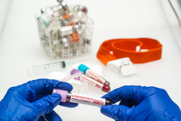 Coronavirus blood test .  Coronavirus positive blood in laboratory. 2019-nCoV Coronavirus originating in Wuhan, China