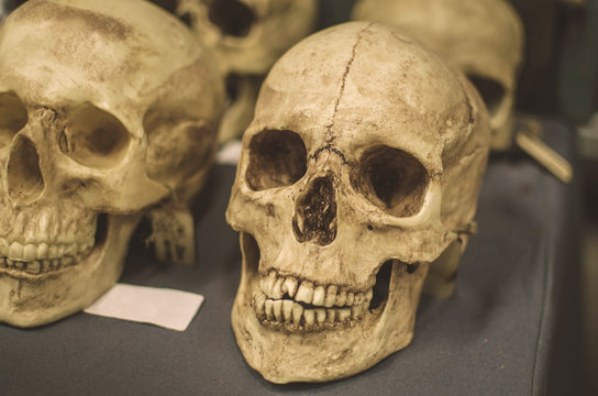 a large human skull. human remains. Excavations