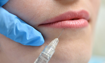 Female lips and syringe with a needle during an injection for lip augmentation. Beauty and health...