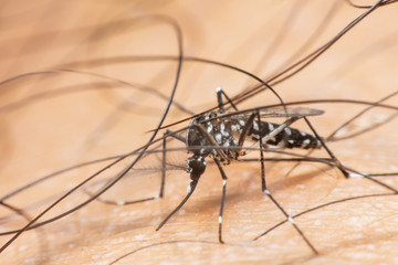 Black culex mosquito sucking blood on human skin. Dengue fever virus.