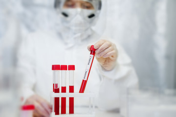 Doctor holding blood sample positive with Coronavirus 2019-nCoV. Corona virus outbreaking.