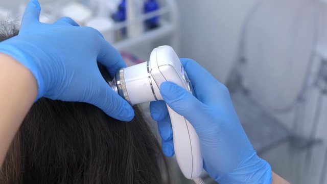 Doctor trichologist examines woman patient's hairs using trichoscope in clinic, closeup hand view. Runs a trichoscope over scalp and sees result on monitor screen. Procedure of computer trichoscopy.
