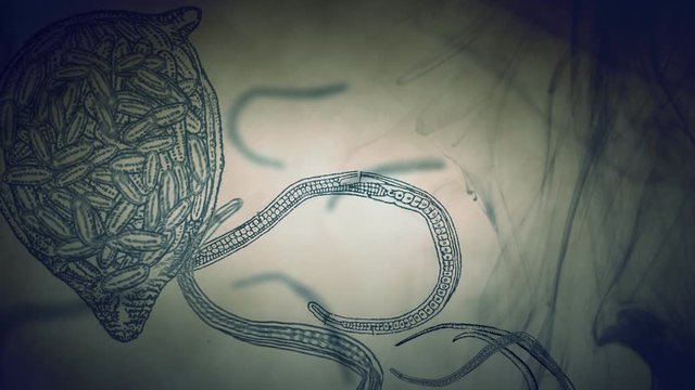 Worms and parasites under the microscope