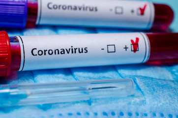 Test tube with positive Coronavirus test blood sample.