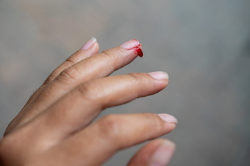 Blood on an injured wound from knife  on women finger.