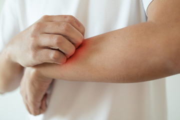 man itching and scratching on arm from itchy dry skin eczema dermatitis