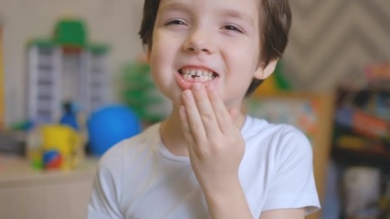 A little boy stands in a children's room and shakes his fingers a milk tooth. The boy pulls a milk tooth out of his mouth and is surprised.