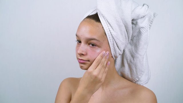 Time lapse teenager with acne on face applying moisturizing cream after bath