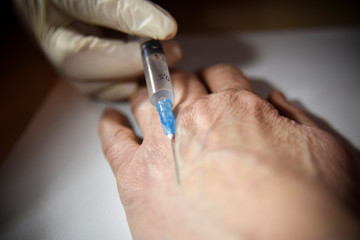Hand in the medical glove with syringe preparing to make an injection into the hand of old person