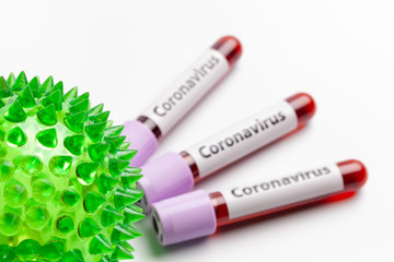 Three blood samples in test tubes and coronavirus cell on white  background. Epidemic Mers-CoV Coronavirus researching and treatment concept.