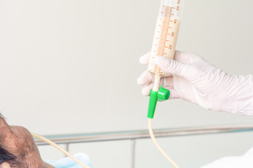 Liquid in cup feeding for patients who can not eat by mouth by Syringe, and home care with special care