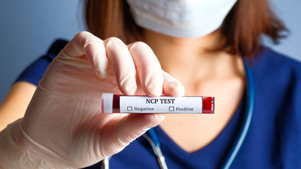 Nurse holding test tube with blood for NCP test. Novel Coronavirus Pneumonia blood analyzing concept.