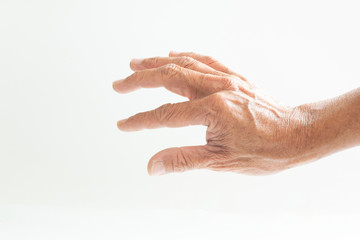 Trigger Finger a defect in a tendon causing a finger to jerk or snap straight when the hand is...