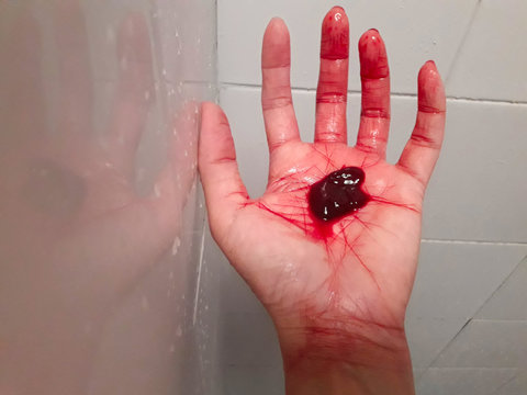 Hand stain Deep red blood clot in hand Symptoms of hemorrhage are life  threatening When there is blood flowing out of the body, should seek  medical attention to treat. Stock Photo