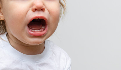 Portrait of a baby toddler child crying. Kid opened his mouth wide, in which fangs erupt and saliva...